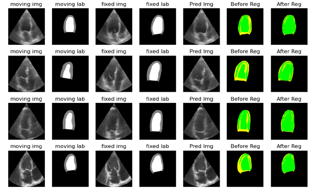 Project Fetal Image Registration